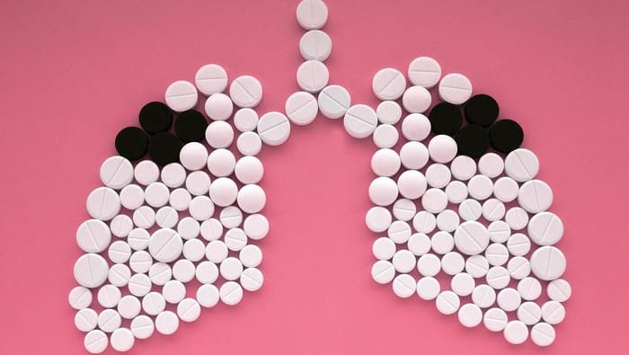 Jawa Barat Penyumbang Kasus TBC Tertinggi di Indonesia